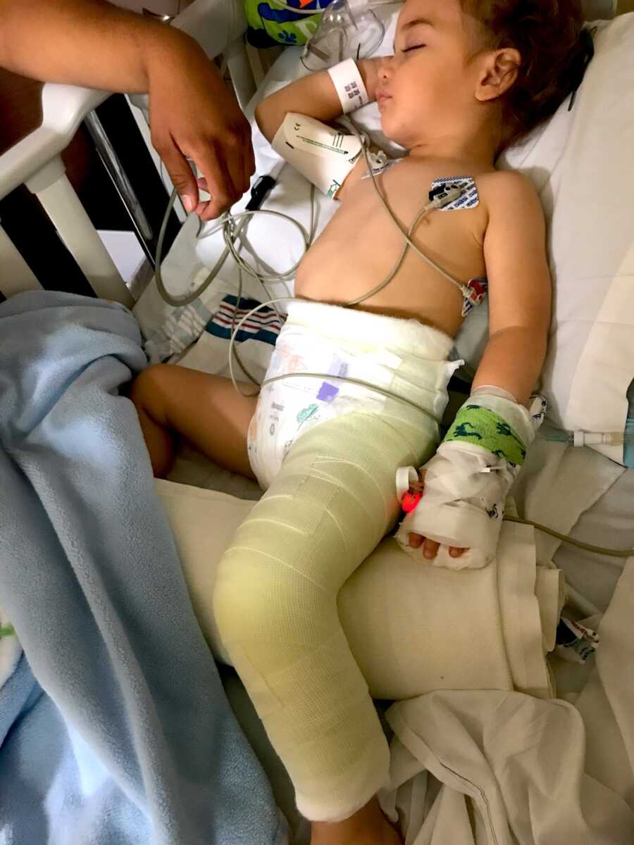 boy lays in hospital bed with a large cast on his leg