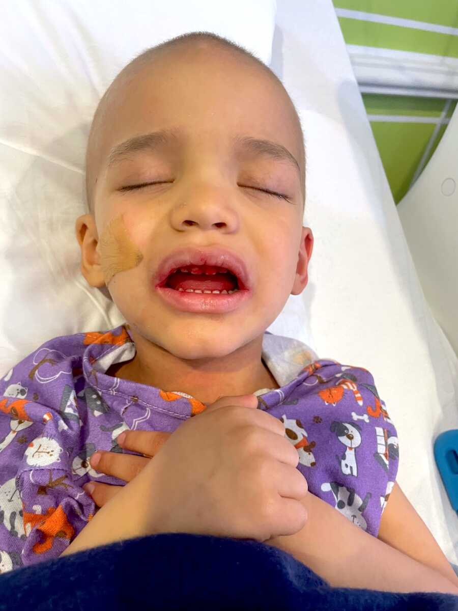 boy with childhood cancer lays in the hospital mouth open and bloody