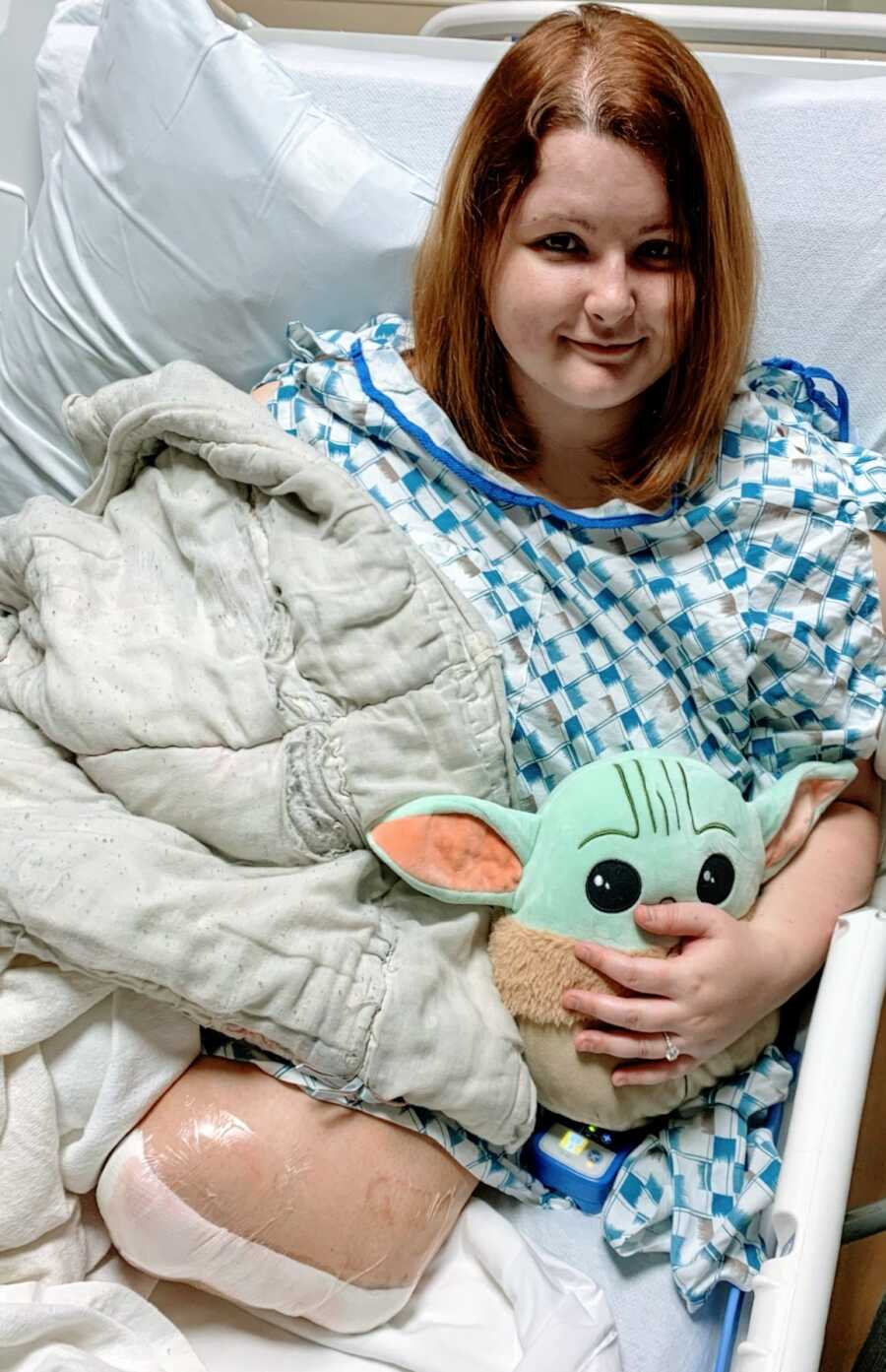 An amputee sitting in a hospital bed