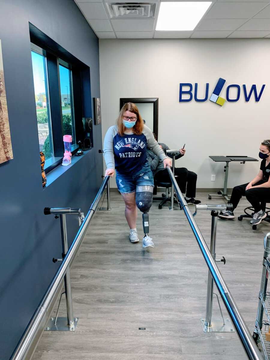 A young woman re-learning to walk on a prosthetic leg