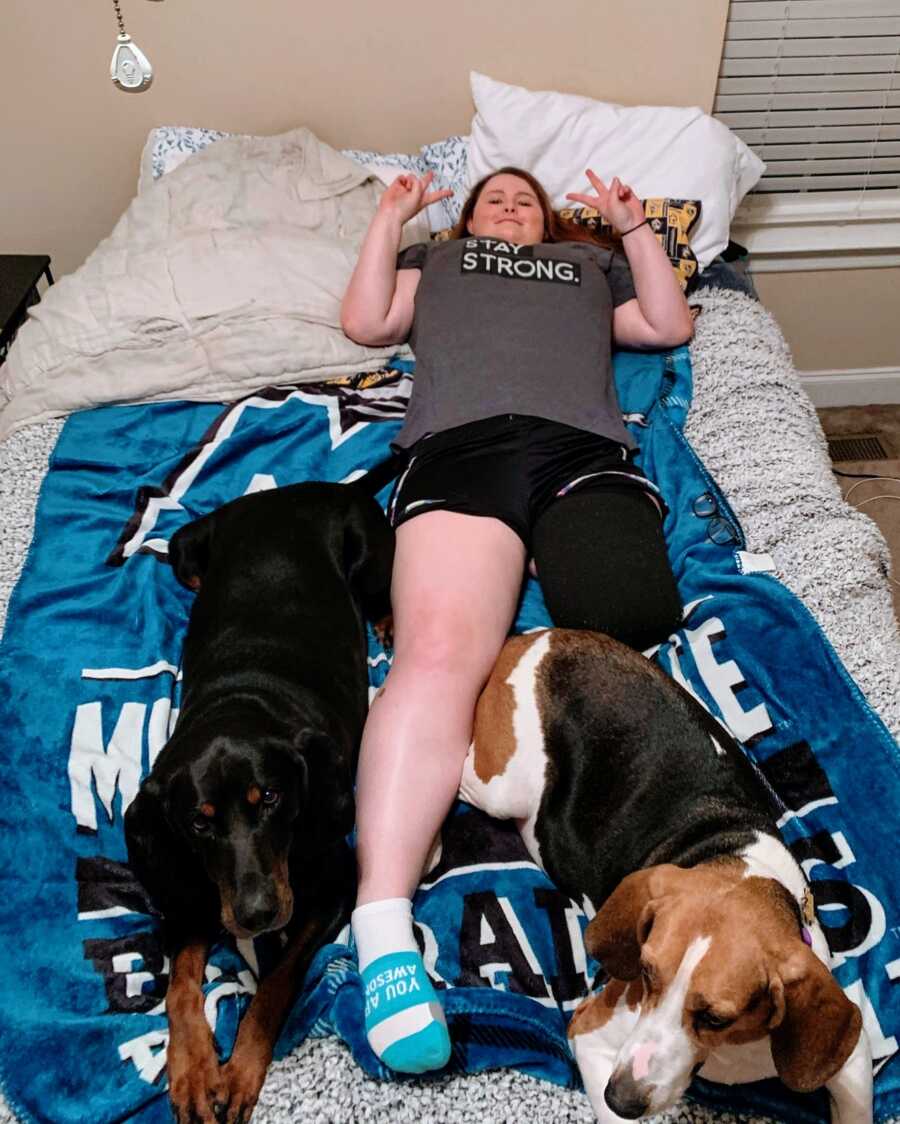 An amputee lying in bed with her two dogs