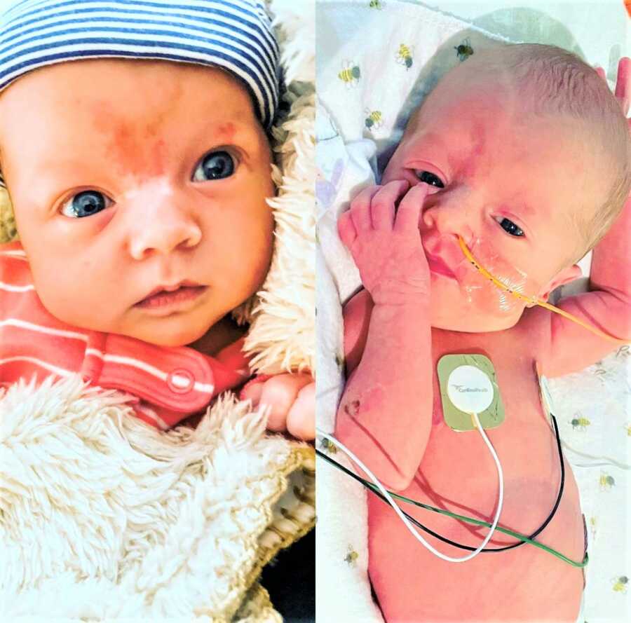 Newborn twin girls at the NICU 