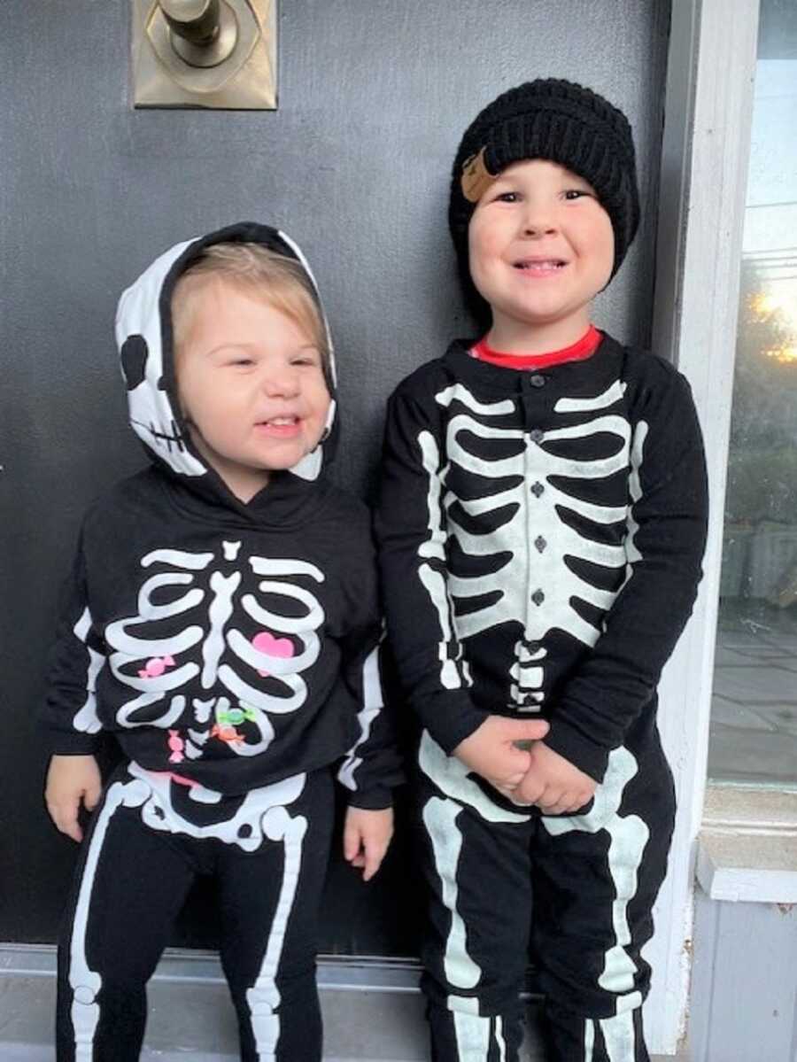 Foster siblings wear matching skeleton outfits for Halloween.