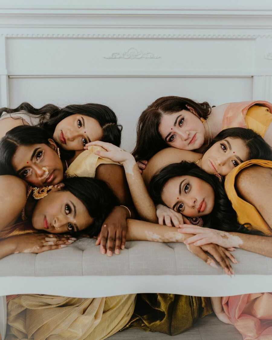 six women with vitiligo rest their heads against one another on a table