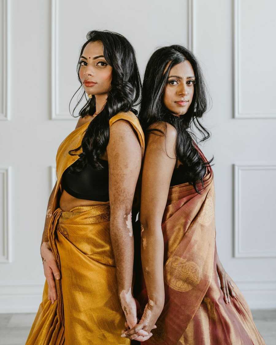 two women with vitiligo stand back to back holding hands