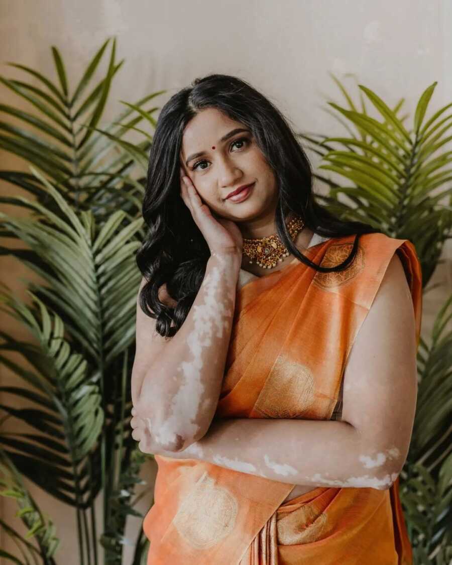 woman with vitiligo poses in traditional clothing in front of tropical leaves