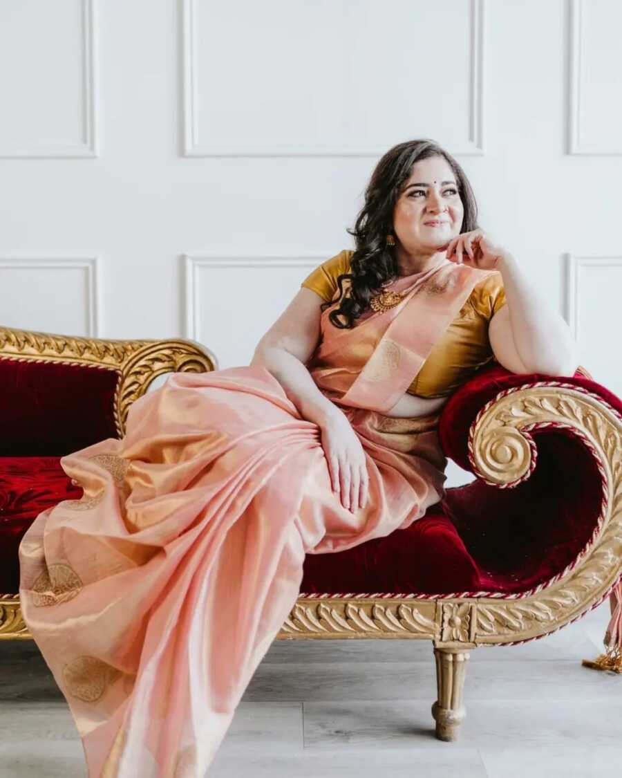 South Asian woman with vitiligo poses on fancy couch 
