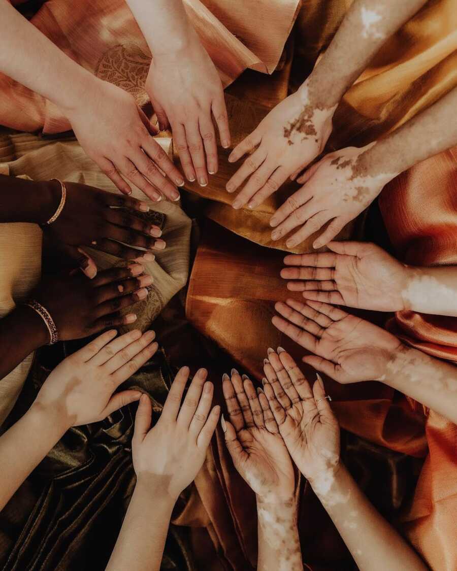 six women with vitiligo show of their hands in order to show their unique skin
