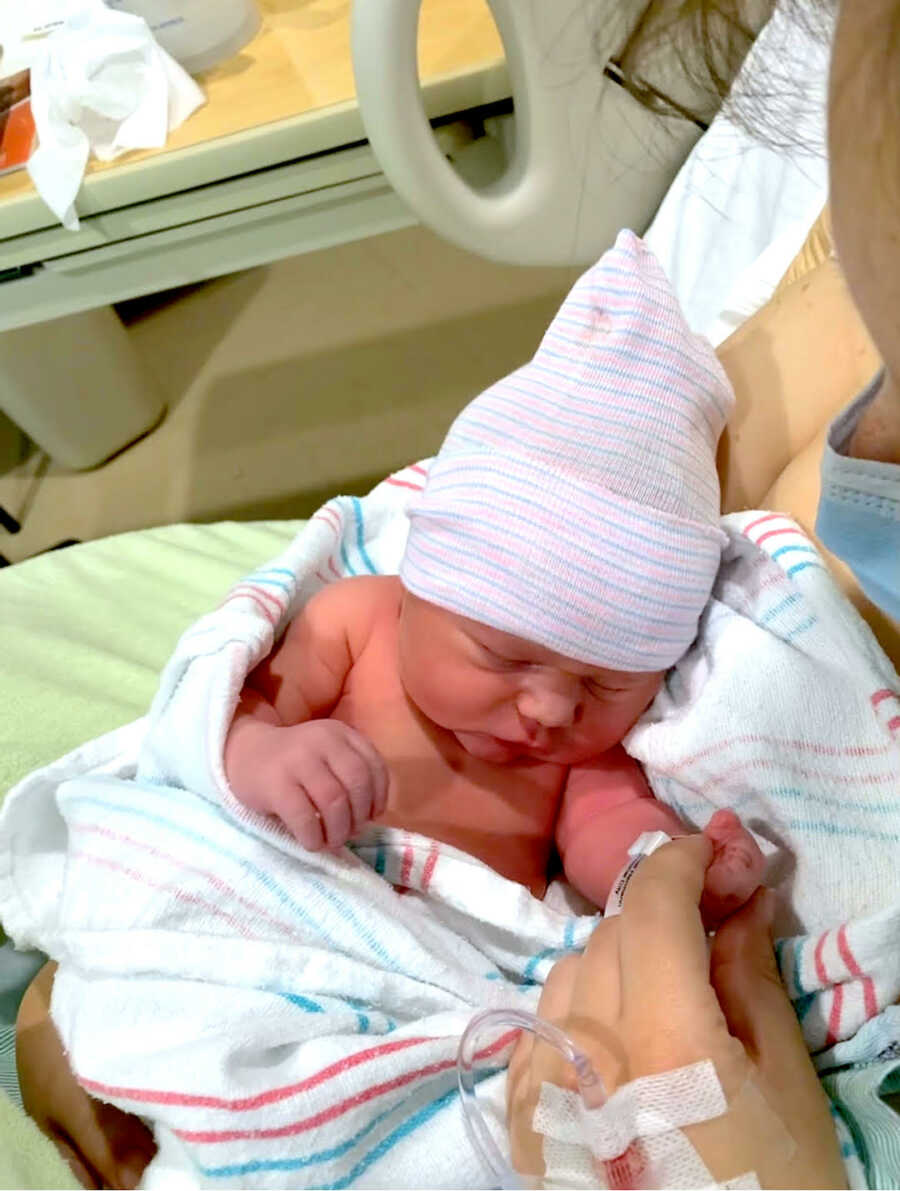 newborn baby with limb difference in the hospital