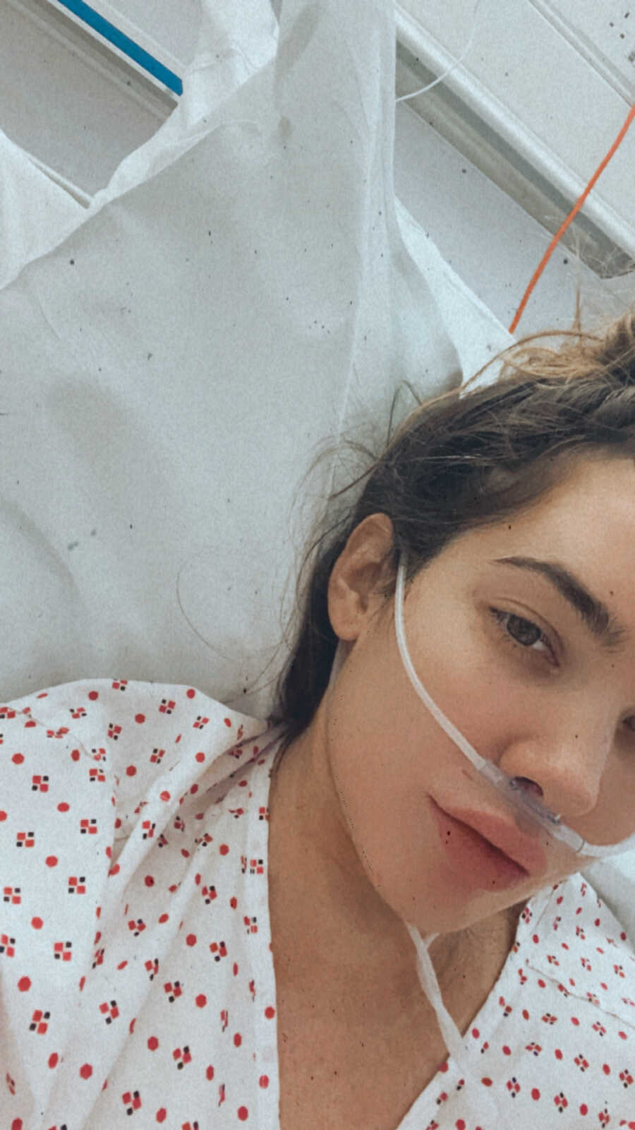 woman lying in hospital bed on oxygen 