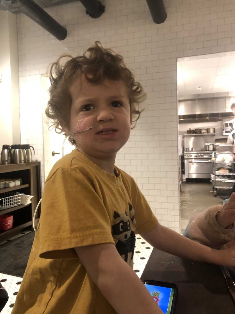 little boy with g-tube on face 