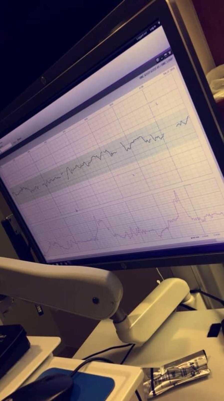 son's heart rate going down