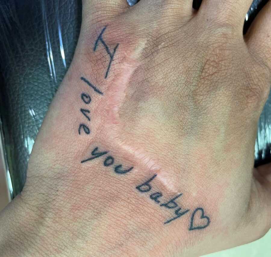 My abuser always told me, 'No one's going to marry you now with that ugly  hand.': Domestic violence survivor gets loving husband's handwriting  tattooed beneath stab wound – Love What Matters