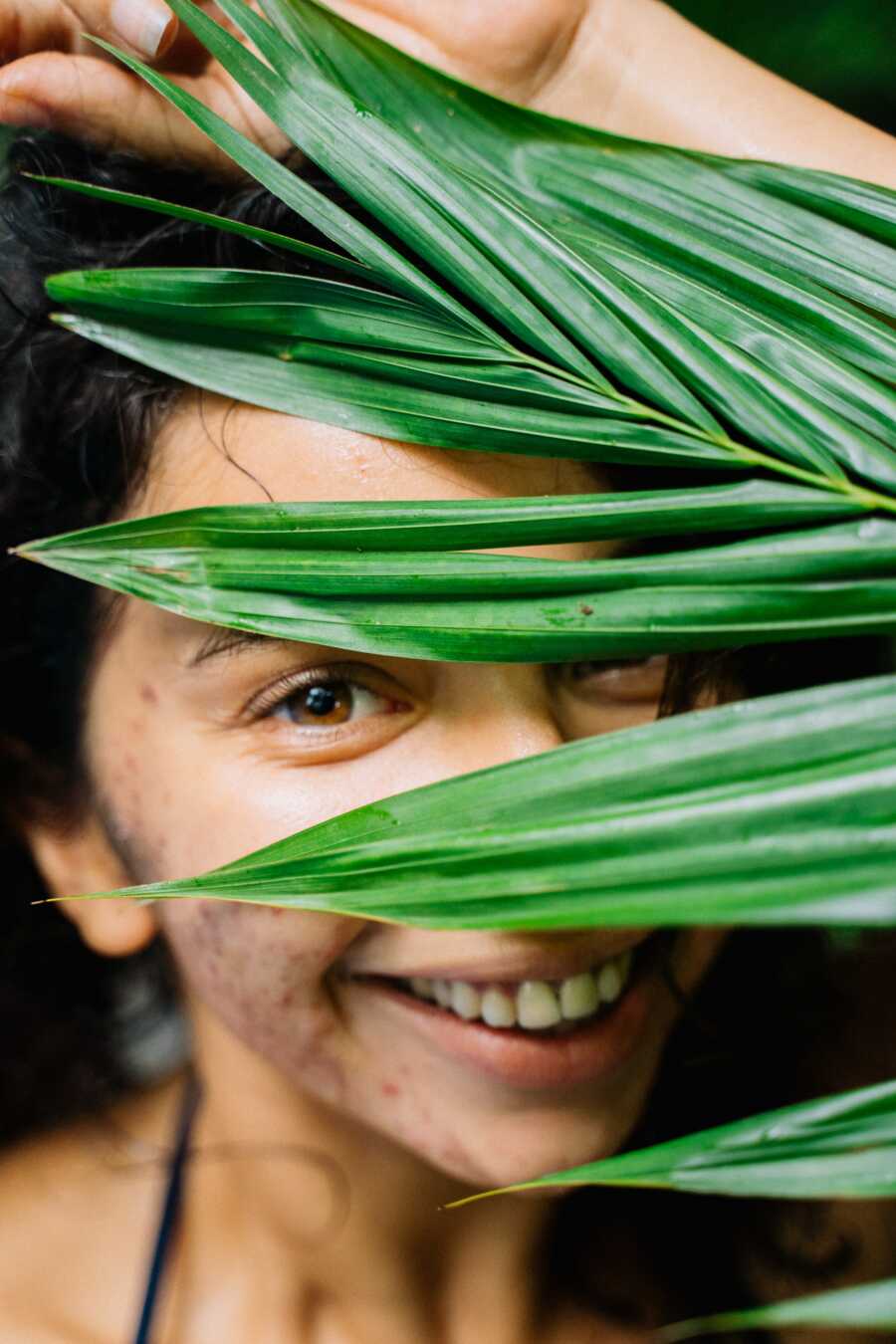 woman with acne hiding behind a leaf smiling