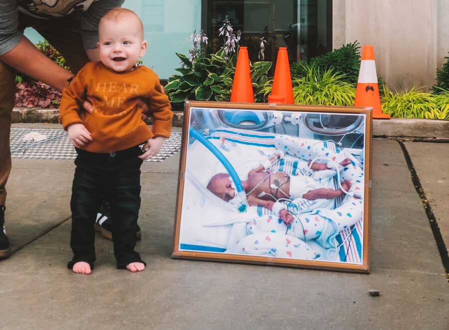 Boy with cerebral palsy stands held up by his dad next to photo of him in the NICU
