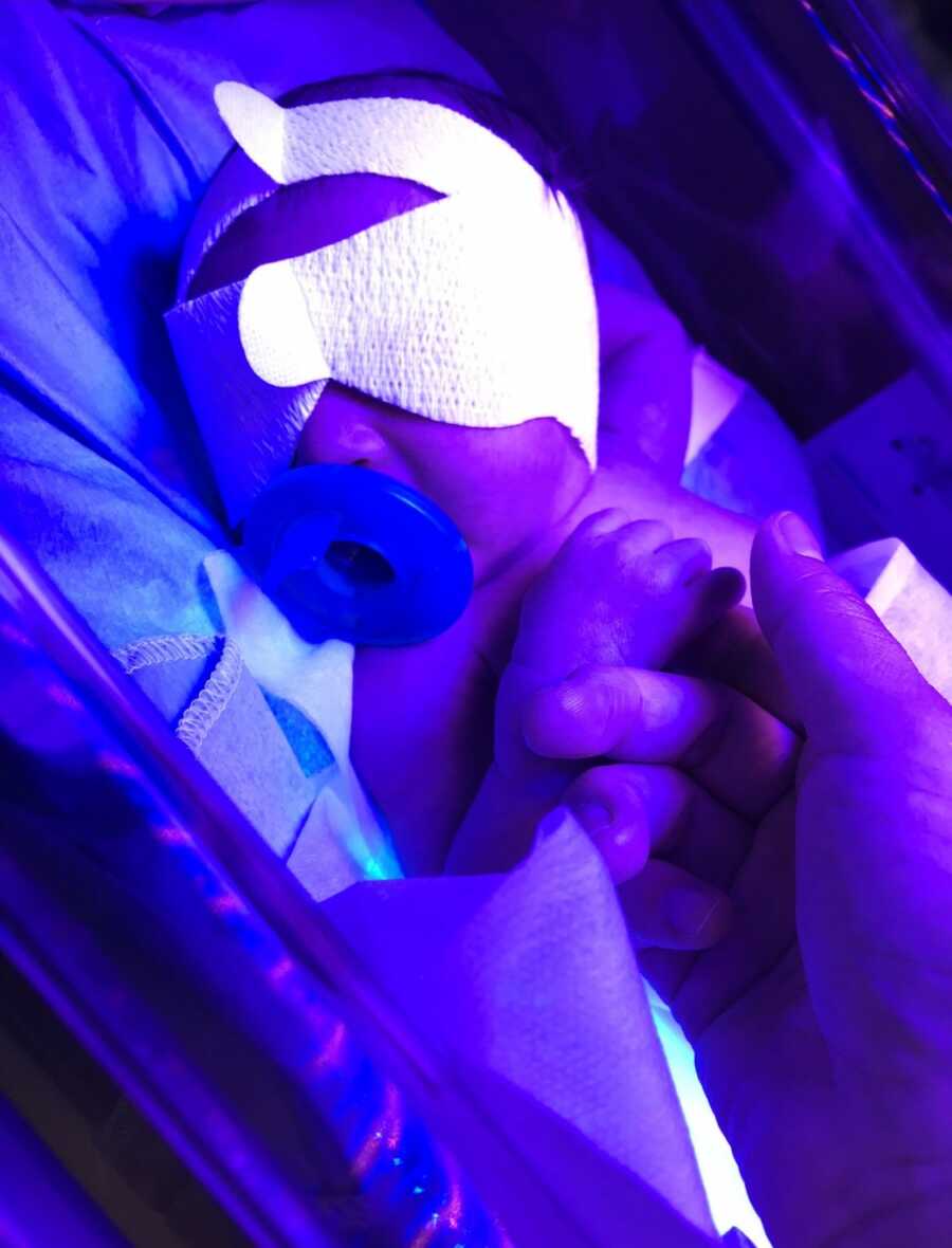 Baby girl with jaundice spends time in the hospital.