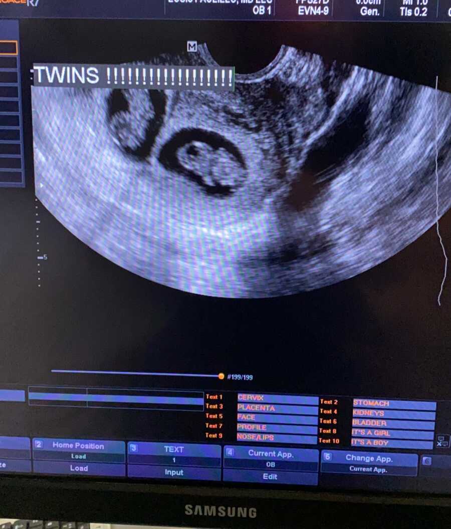 twin ultra sound