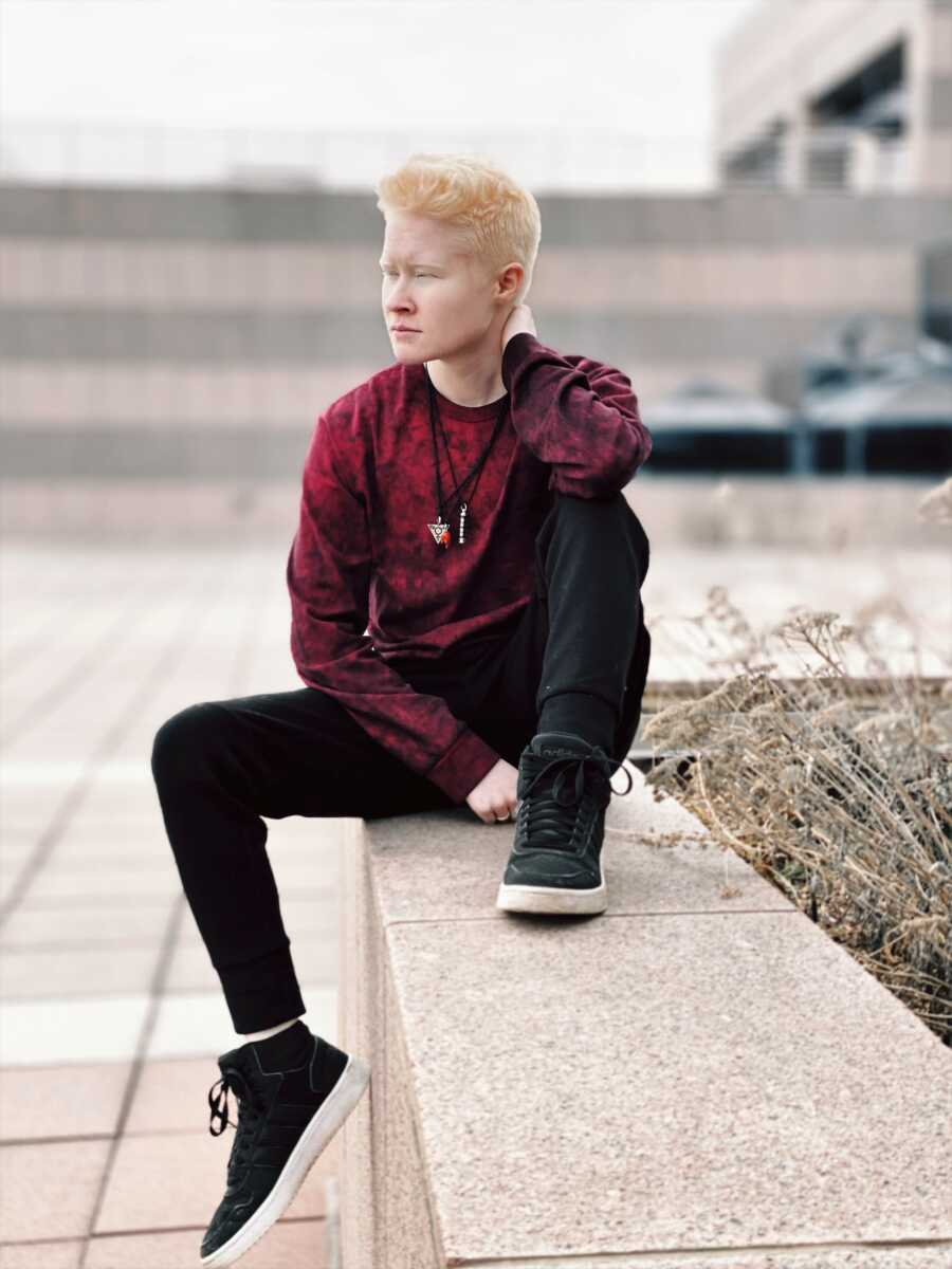 albino person posing on bricks