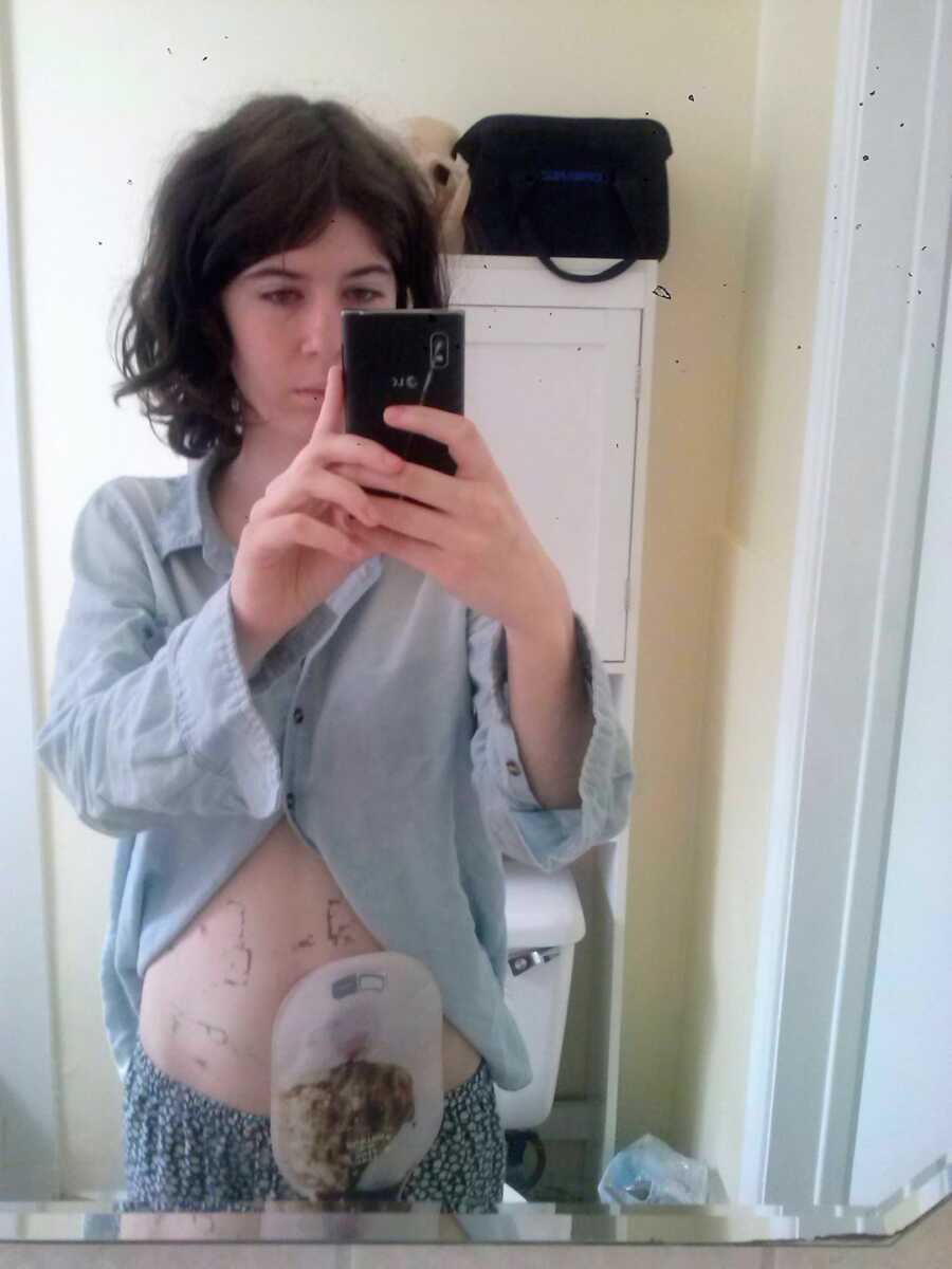 woman in mirror with bag on stomach 