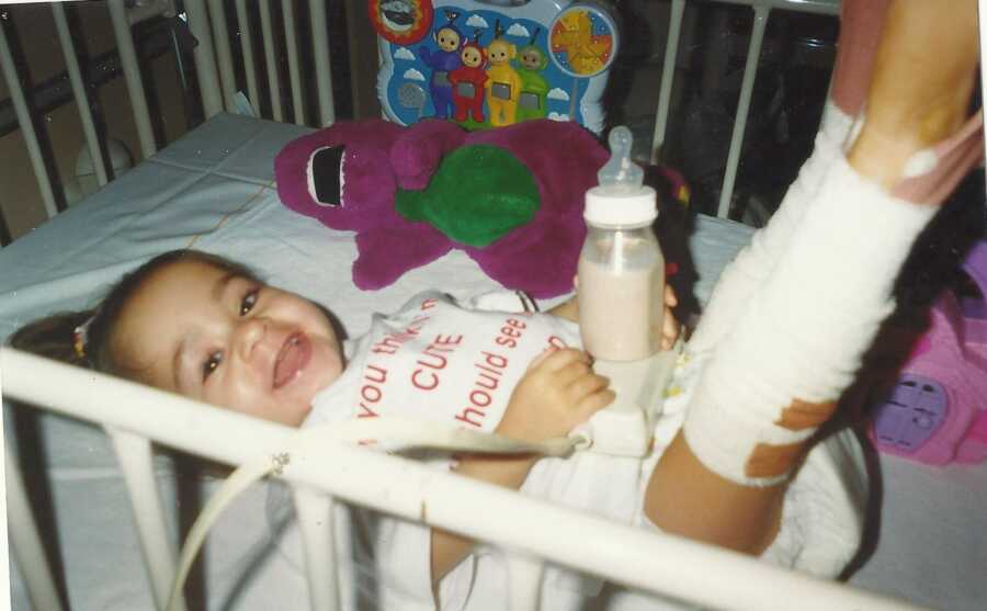 little girl with her legs in casts