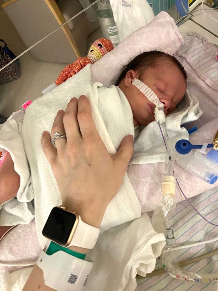 mom rests hand on baby with nager syndrome while in NICU
