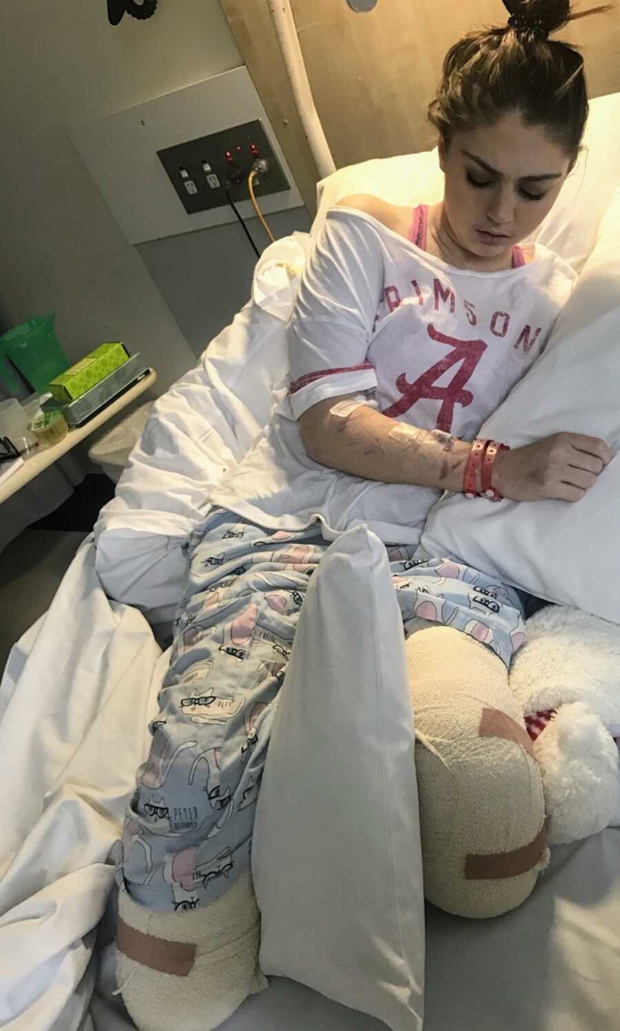suicide survivor and amputee lays in hospital bed after amputation