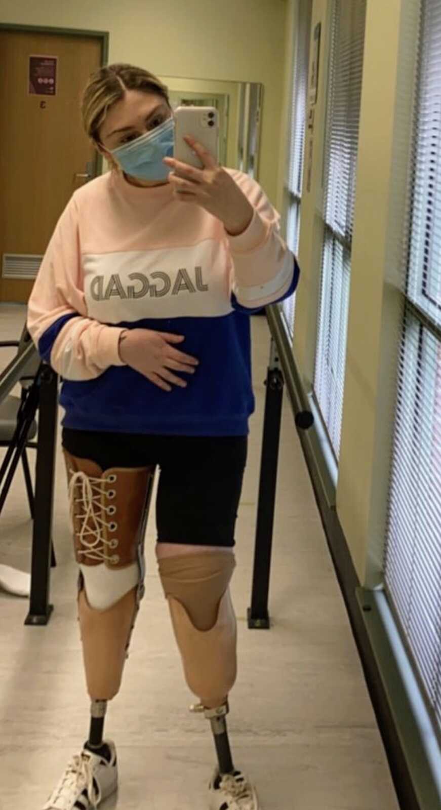 double amputee stands in her prosthetics