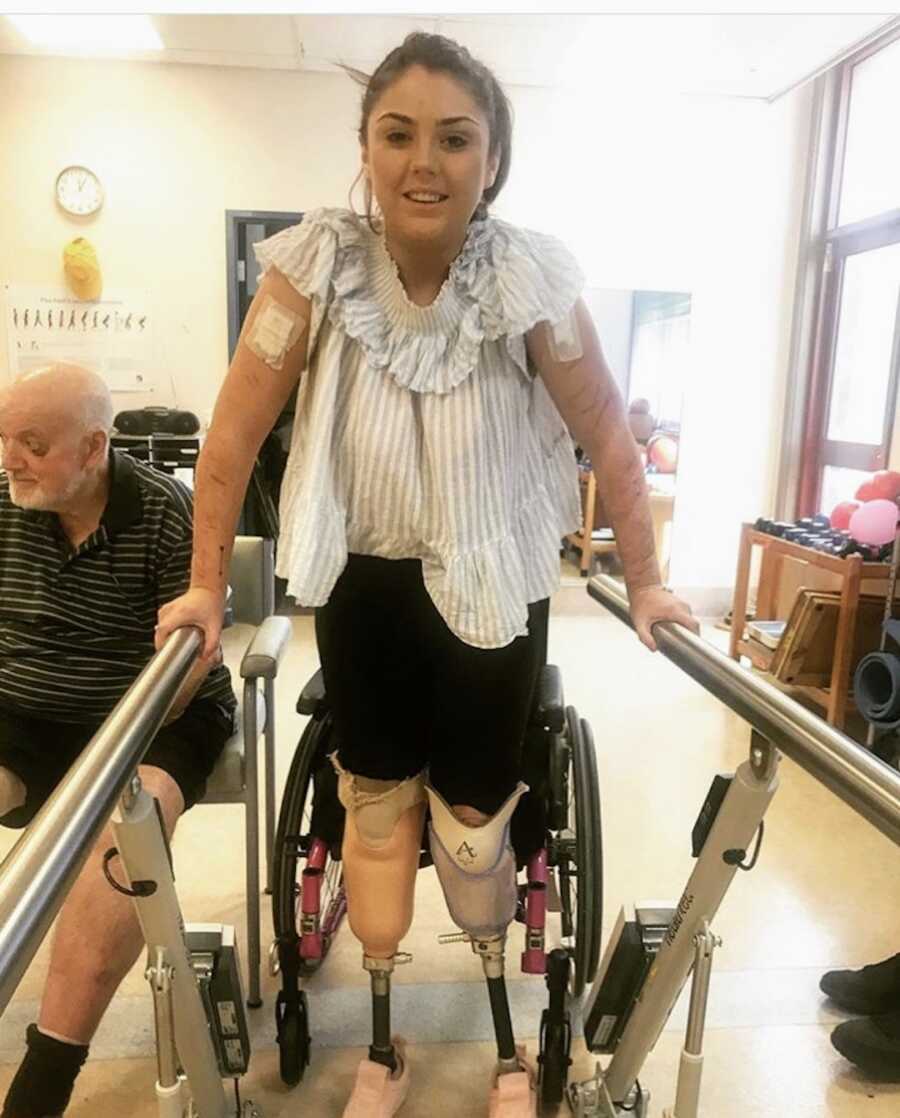 double amputee suicide survivor stands using new prosthetics