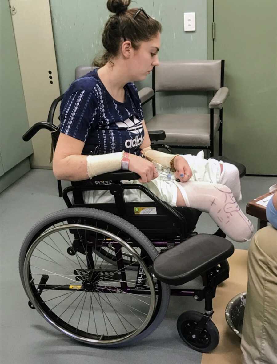 double leg amputee and suicide survivor sits in wheelchair at therapy