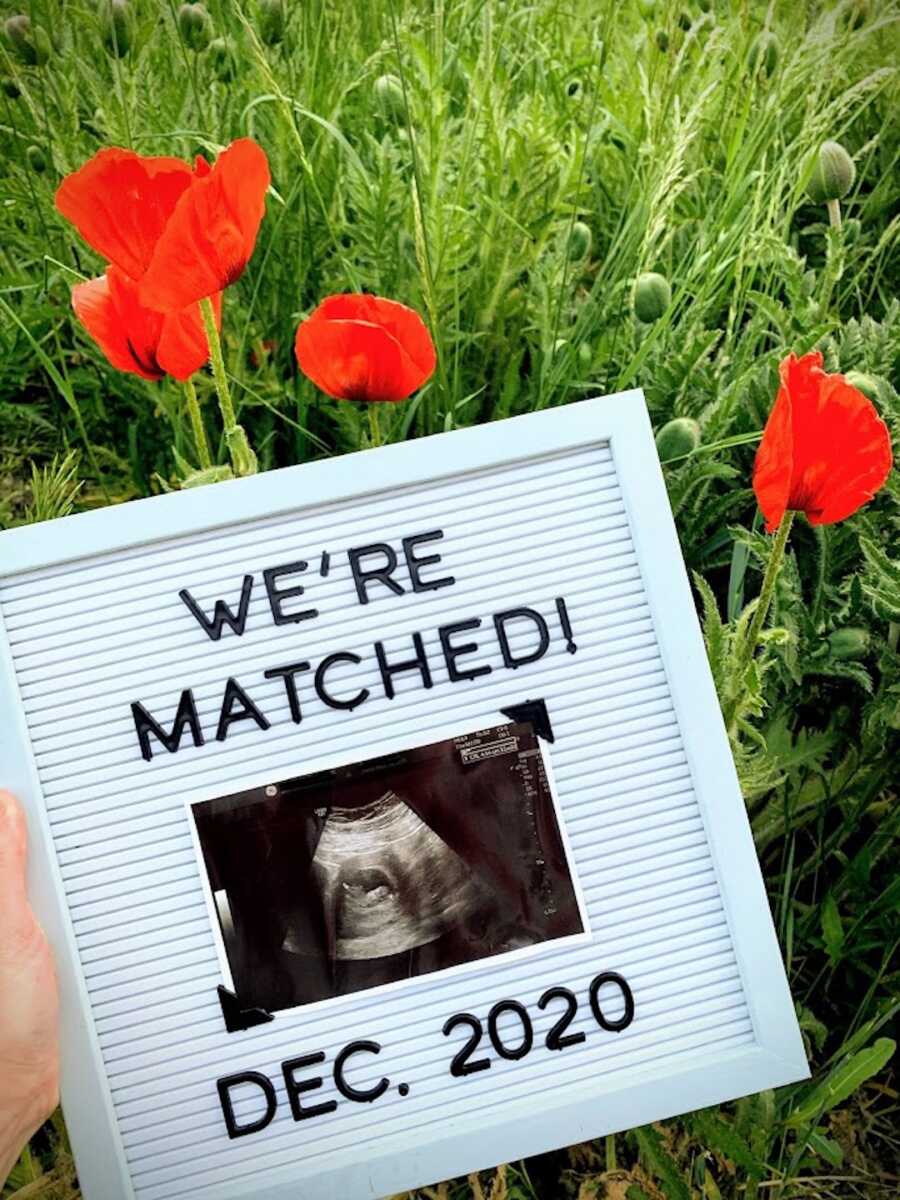 letter sign with ultrasound picture, couple announces match for adoption