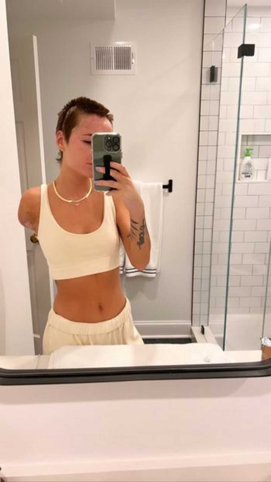 Woman takes a selfie of her amputated arm in the bathroom mirror.