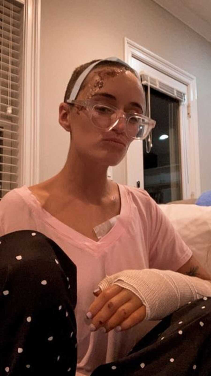 Car accident survivor in bandages and cast after recent surgeries.