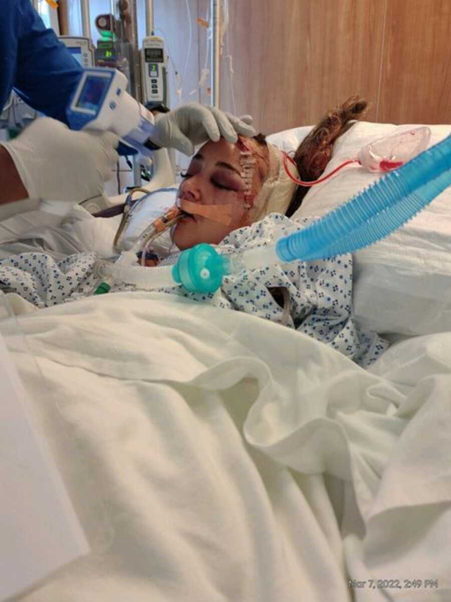 Car accident survivor lies in hospital bed with tubes and wires connected to her.