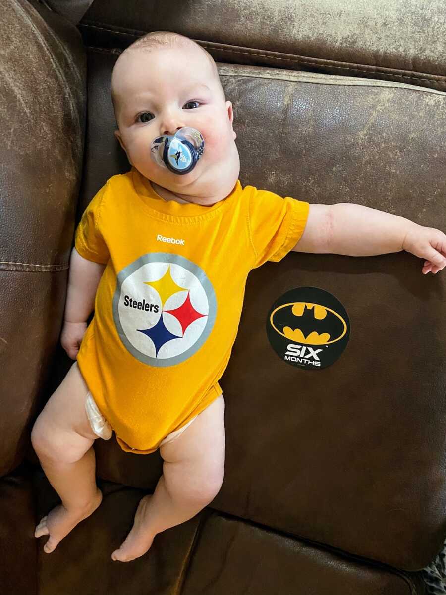 infant boy in a sports onesie with a neck cyst