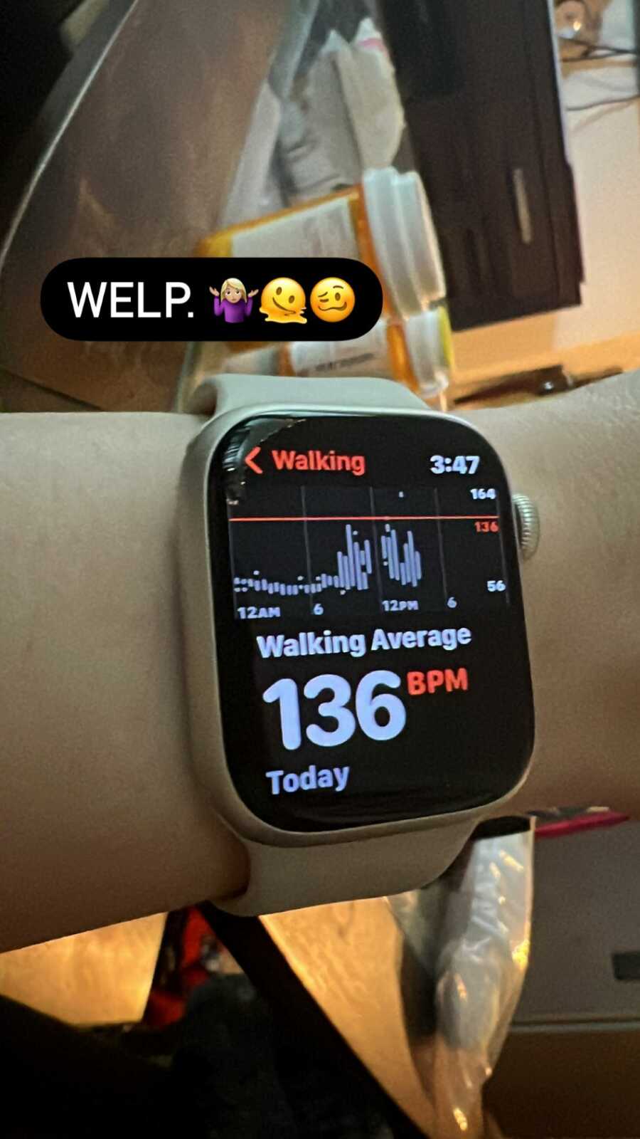A picture of an apple watch monitor