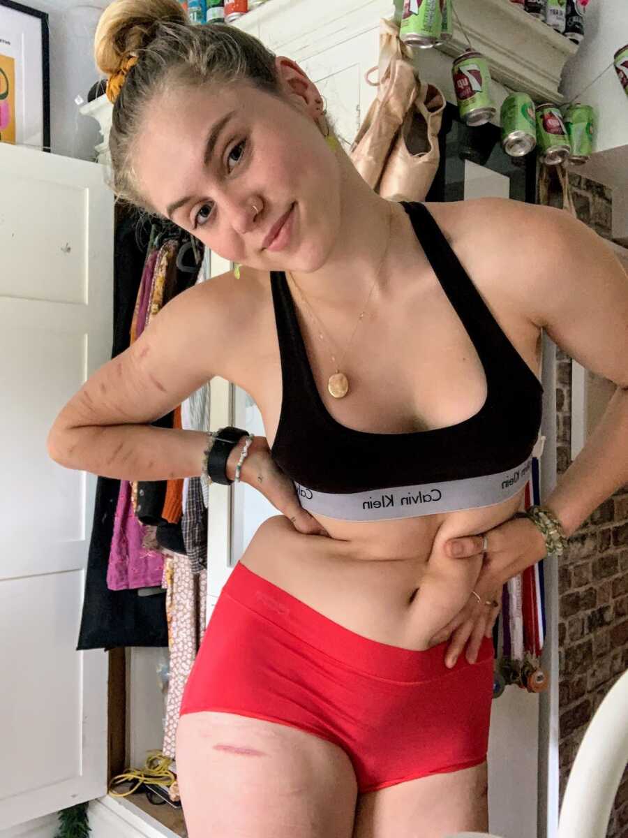 self harm survivor in sports bra and running shorts