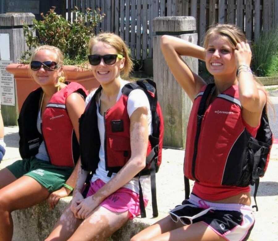 teenager girl with vitiligo sitting with two other girls wearing life jackets