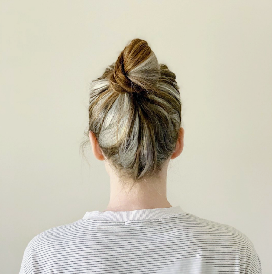 vitiligo woman with her hair that is losing pigment in a bun