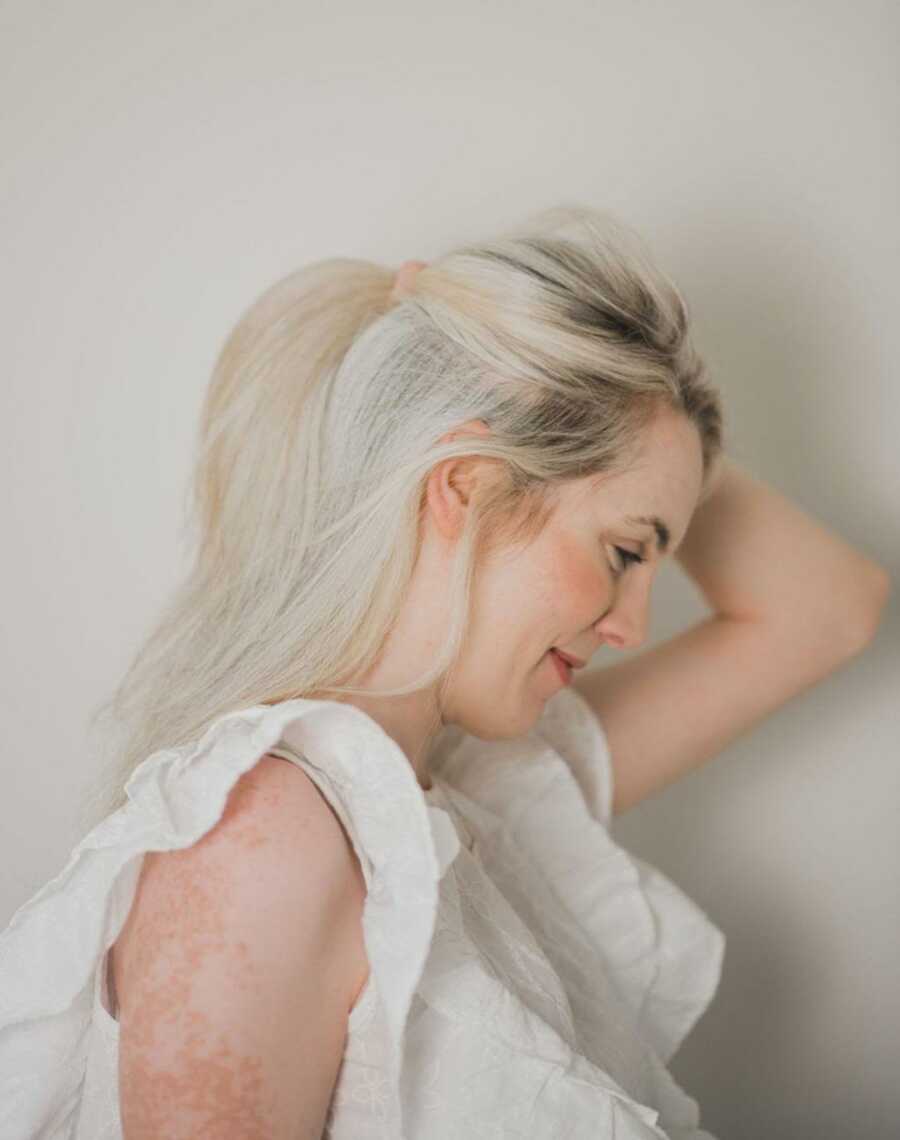 vitiligo woman with white hair pulling her hair into a ponytail