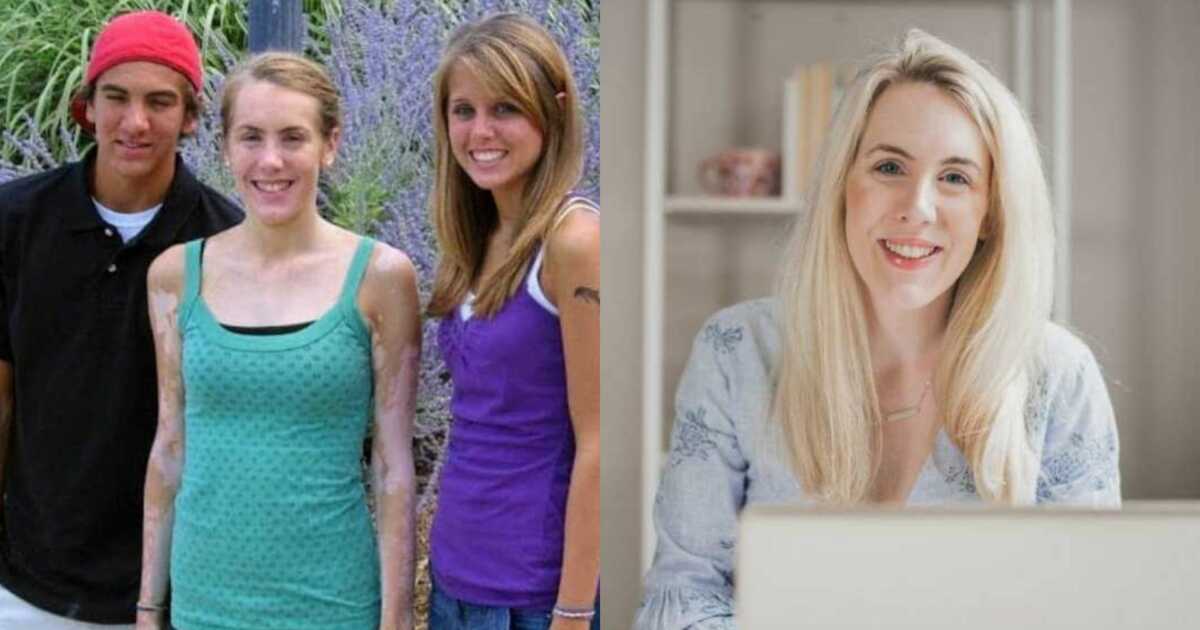 ‘I turned to tanner to ‘get back’ the skin I felt I’d lost.’ Woman