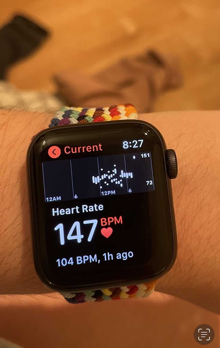 chronically ill woman's Apple watch displaying a high heart rate