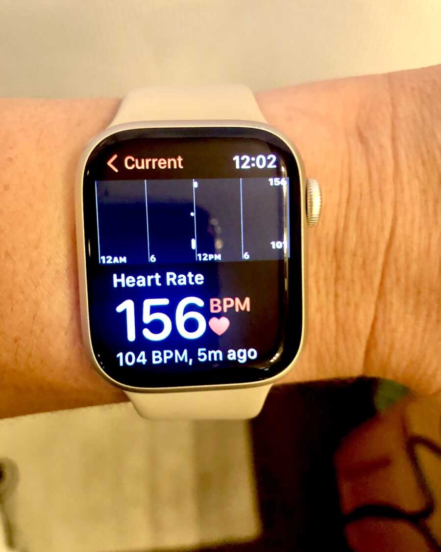 Apple watch screen showing high heart rate of 156 bpm
