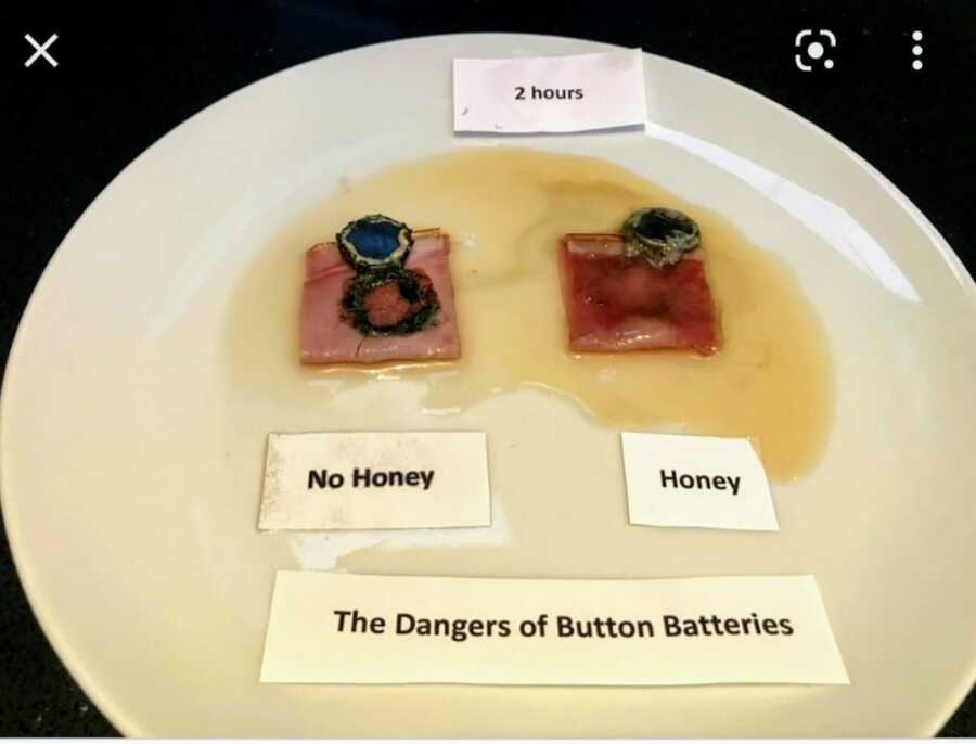 plate showing effects of battery with and without honey