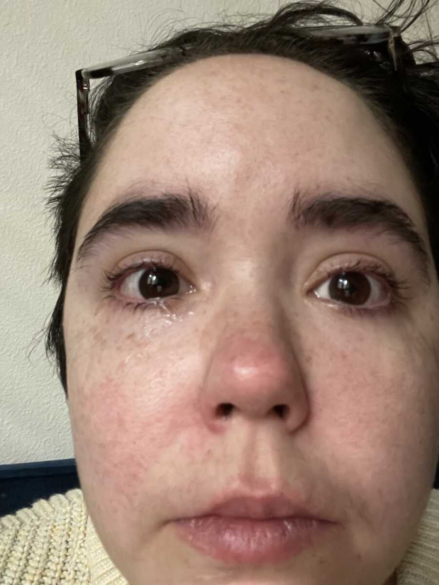 autistic, chronically ill woman lifts up glasses and is crying