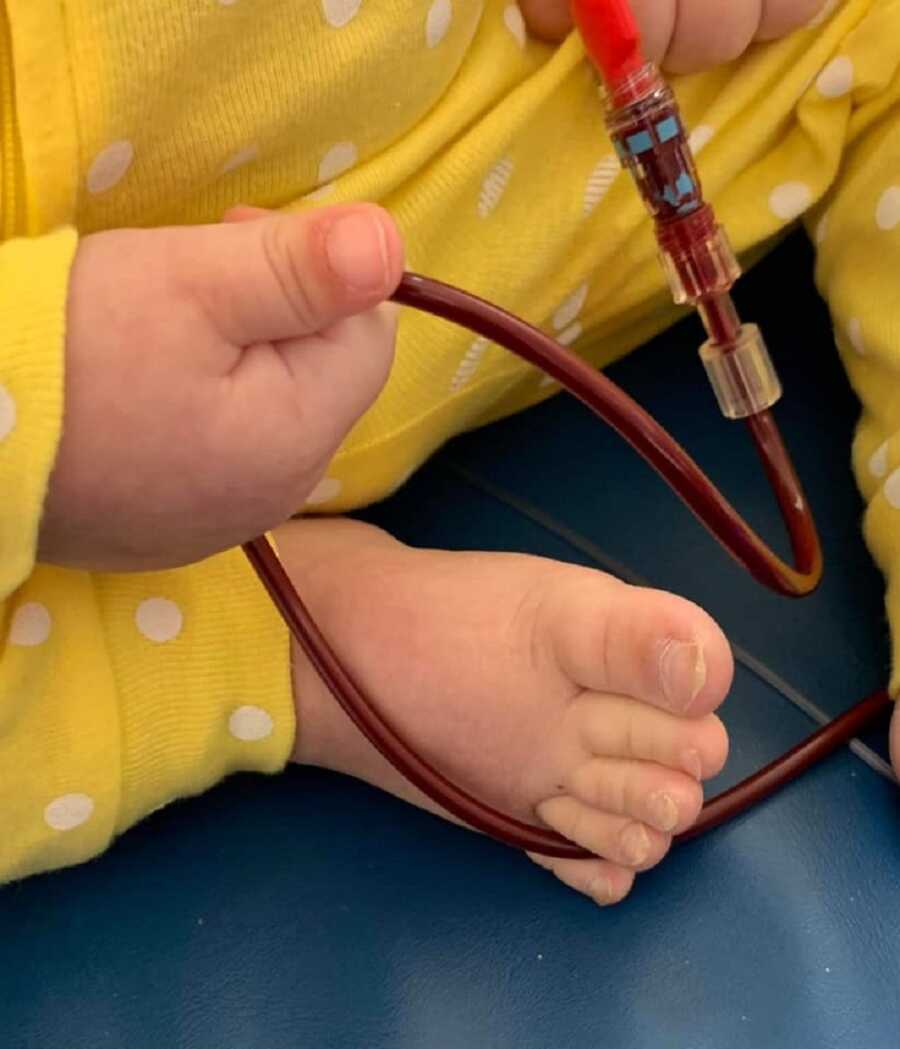 foster baby with brain cancer holds tube during treatment