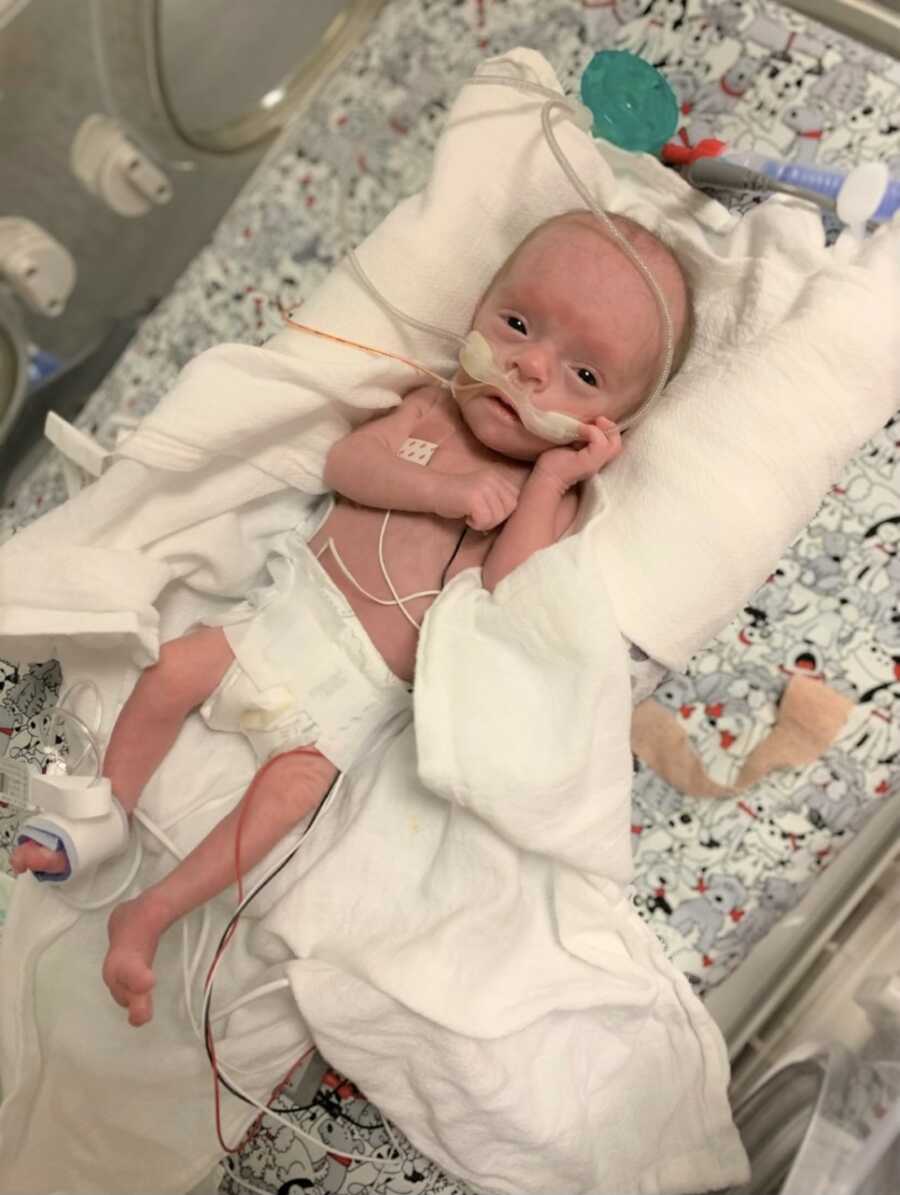 NICU preemie in hospital incubator