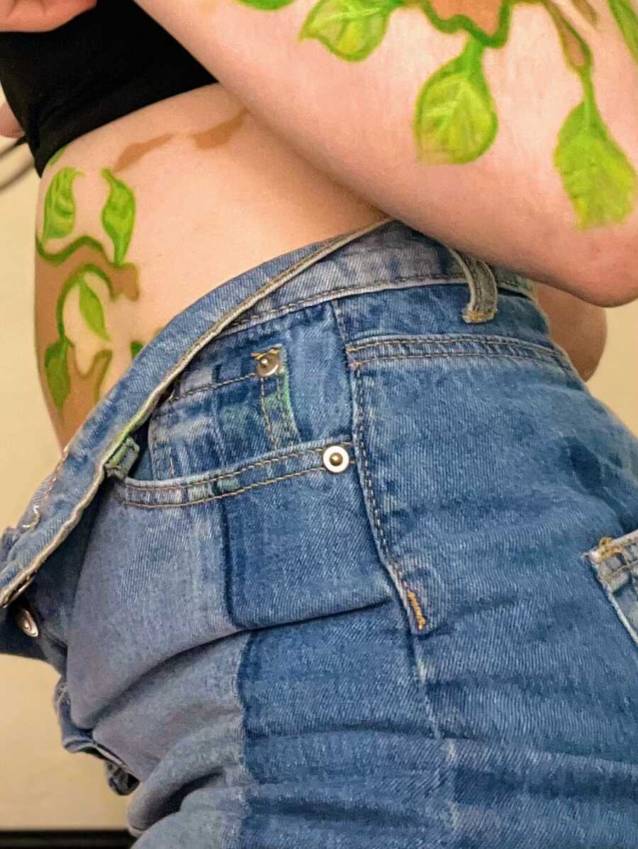 girl with vitiligo with painted leaves on stomach patches