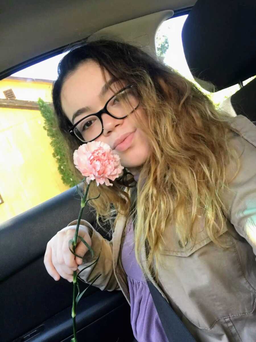 girl with vitiligo holding a flower