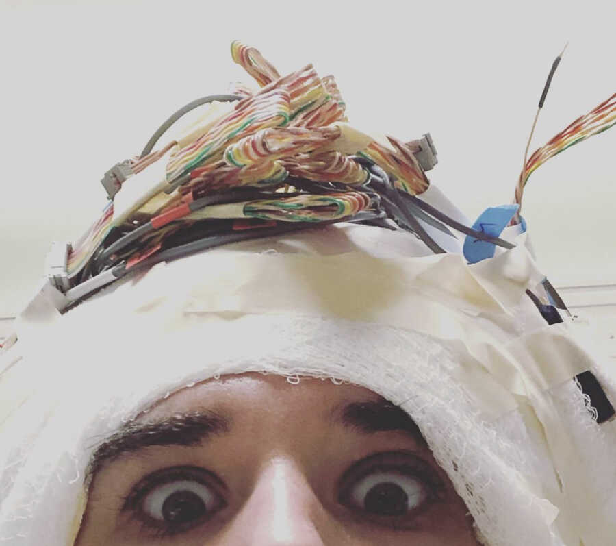 woman with epilepsy getting testing with wires and wrapping on head