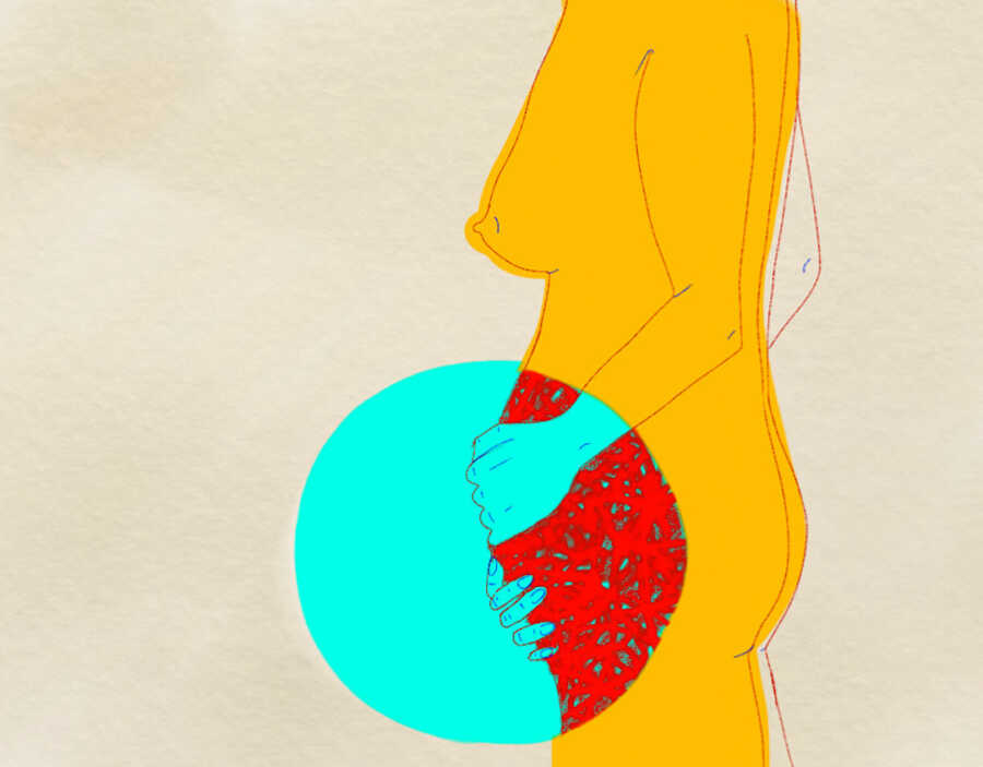 artwork showing what pain feels like whole having endometriosis